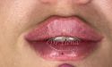 image_17382
