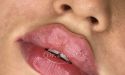 image_17387